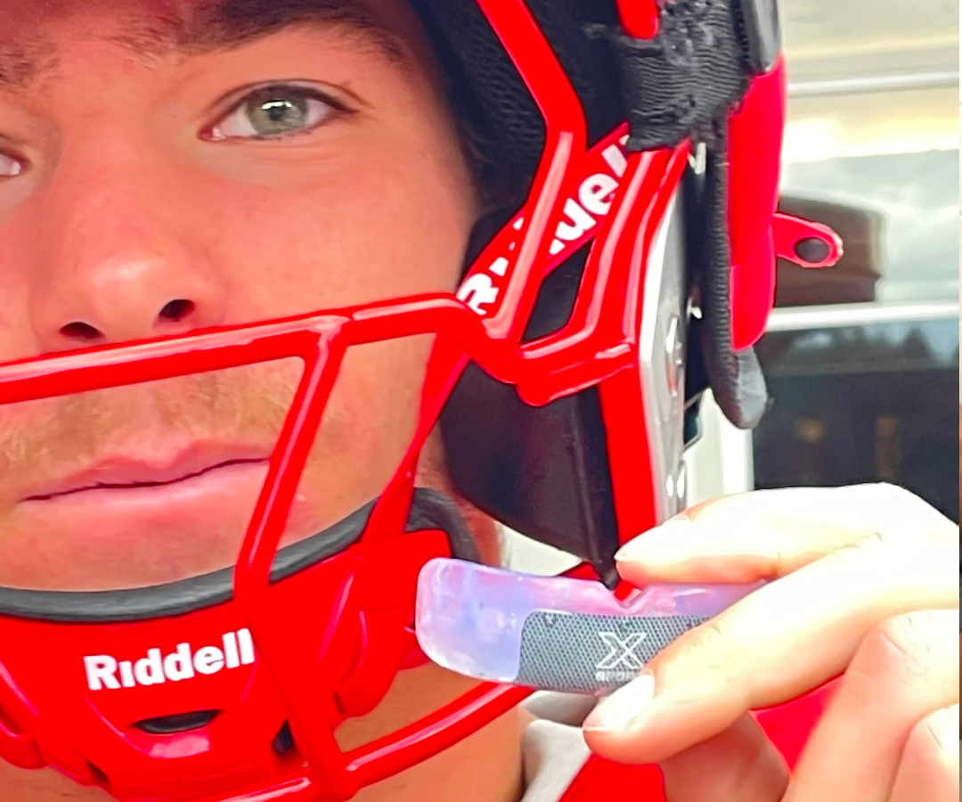 XSport Mouthguards